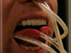 sinus straws, close-up