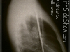X-ray of Andrew S. sword swallowing / SIDE